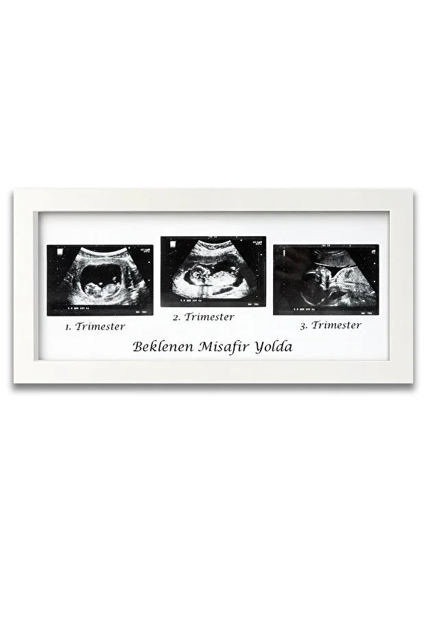Bebek Ultrason Fotoğraf Çerçevesi 3'lü Triemester, Sonogram Anı Çerçevesi, Yeni Anne Hamile