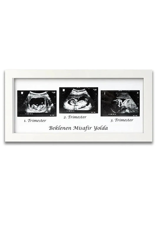 Bebek Ultrason Fotoğraf Çerçevesi 3'lü Triemester, Sonogram Anı Çerçevesi, Yeni Anne Hamile