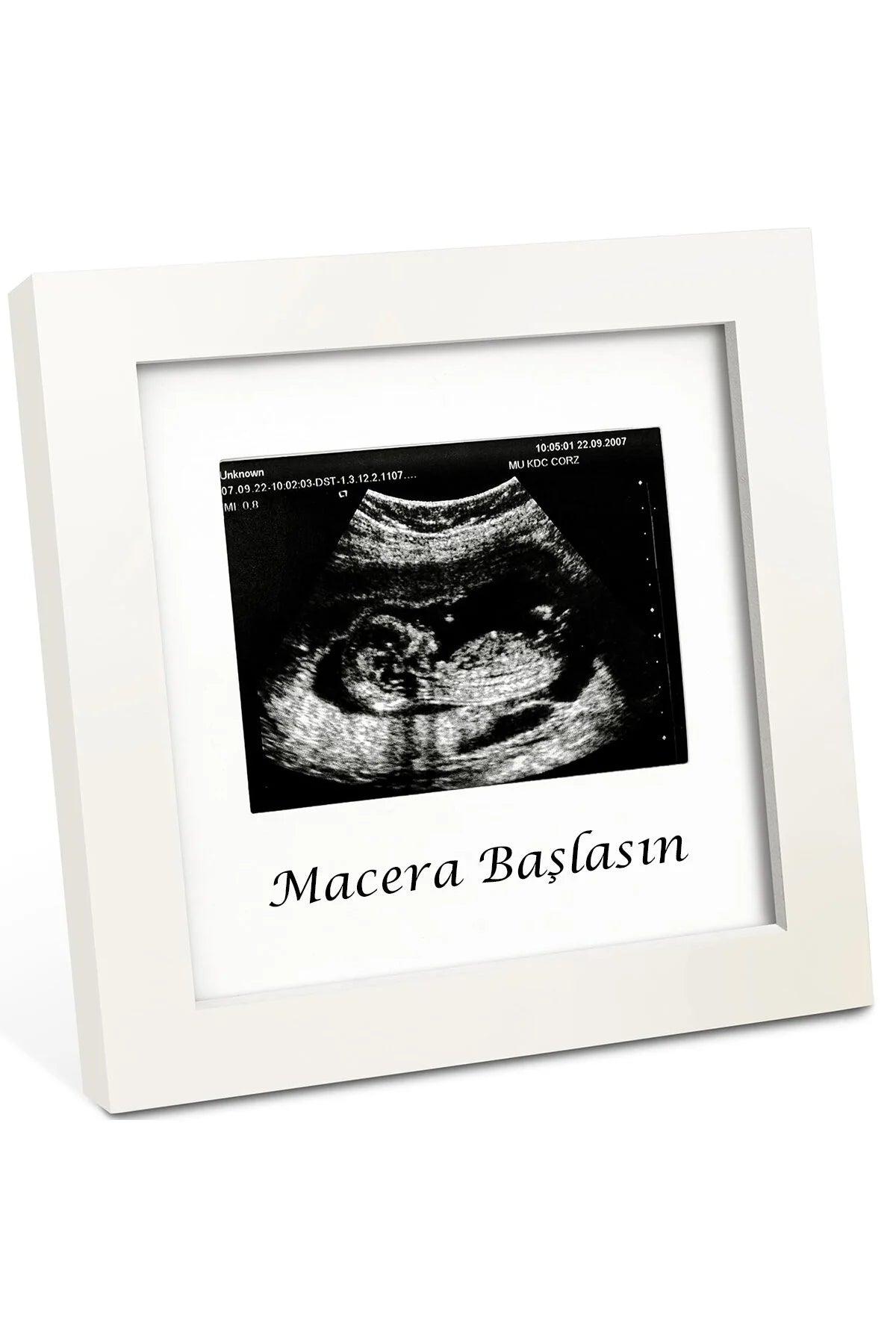 Bebek Ultrason Fotoğraf Anı Çerçevesi, Yenidoğan İlk Fotoğrafım Resim Hatırası, Baby Shower