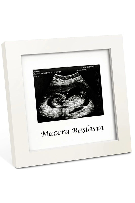 Bebek Ultrason Fotoğraf Anı Çerçevesi, Yenidoğan İlk Fotoğrafım Resim Hatırası, Baby Shower