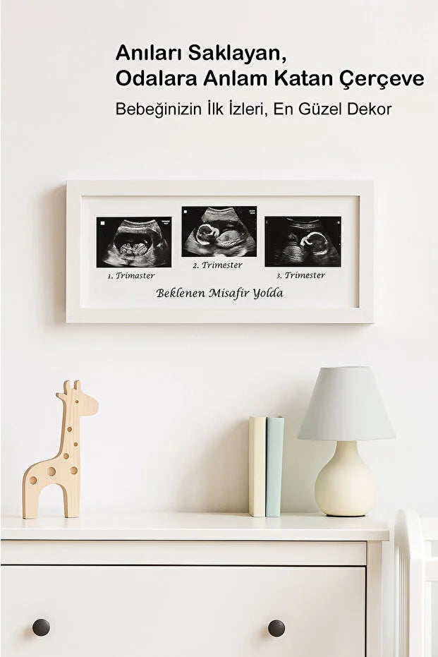 Bebek Ultrason Fotoğraf Çerçevesi 3'lü Triemester, Sonogram Anı Çerçevesi, Yeni Anne Hamile
